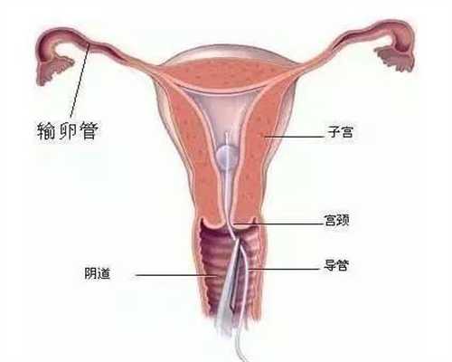 宁波借卵自孕 1浙江宁波906医院试管婴儿怎么样? ‘4个月做b超看男女’